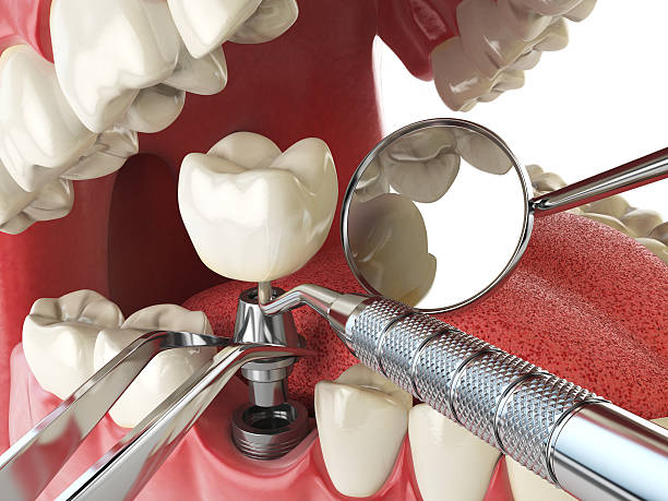 Best Emergency Tooth Extraction in Strathmore, NJ